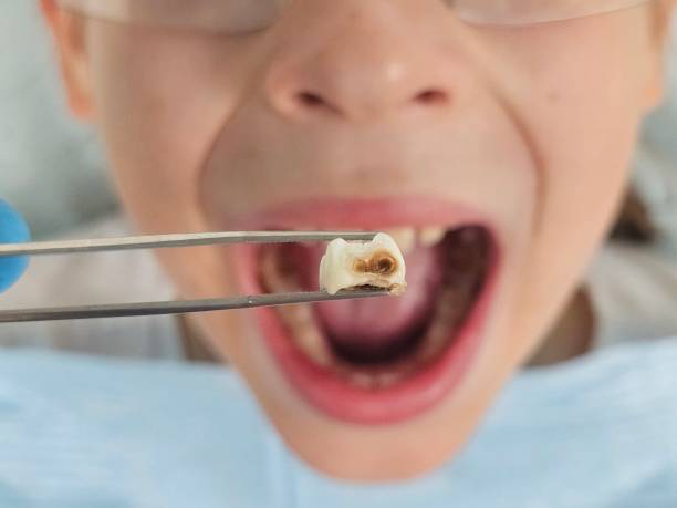 Best Emergency Pediatric Dental Care in Piednt, MO